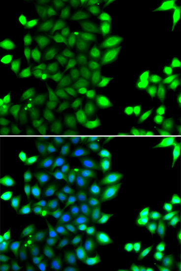 RNF7 Rabbit Polyclonal Antibody