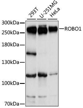 ROBO1 Rabbit Polyclonal Antibody