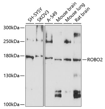 ROBO2 Rabbit Polyclonal Antibody