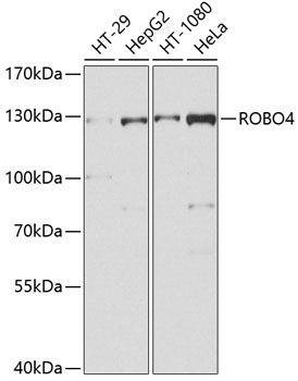 ROBO4 Rabbit Polyclonal Antibody