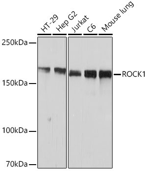 ROCK1 Rabbit Monoclonal Antibody
