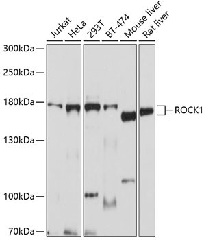 ROCK1 Rabbit Polyclonal Antibody
