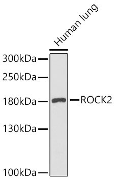 ROCK2 Rabbit Polyclonal Antibody