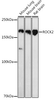 ROCK2 Rabbit Polyclonal Antibody