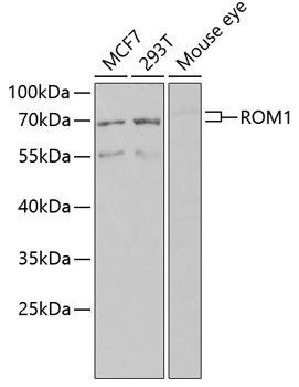 ROM1 Rabbit Polyclonal Antibody