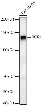 ROR1 Rabbit Polyclonal Antibody