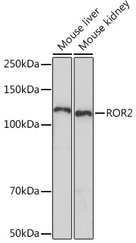 ROR2 Rabbit Monoclonal Antibody