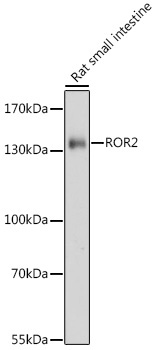 ROR2 Rabbit Polyclonal Antibody