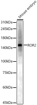 ROR2 Rabbit Polyclonal Antibody