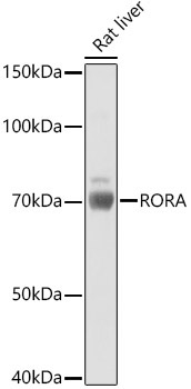 RORA Rabbit Polyclonal Antibody