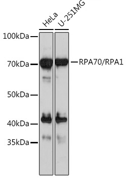RPA70/RPA1 Rabbit Monoclonal Antibody