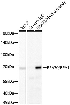 RPA70/RPA1 Rabbit Monoclonal Antibody - Image 2