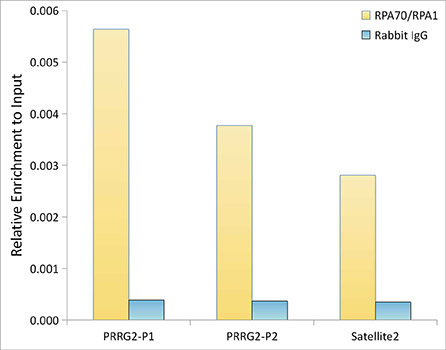 RPA70/RPA1 Rabbit Monoclonal Antibody - Image 3