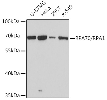 RPA70/RPA1 Rabbit Polyclonal Antibody