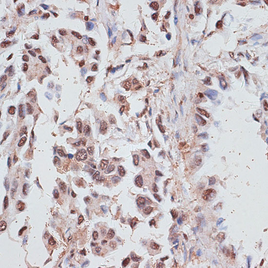 RPA70/RPA1 Rabbit Polyclonal Antibody - Image 2