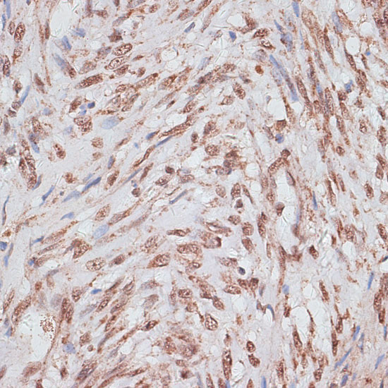 RPA70/RPA1 Rabbit Polyclonal Antibody - Image 3