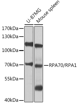 RPA70/RPA1 Rabbit Polyclonal Antibody