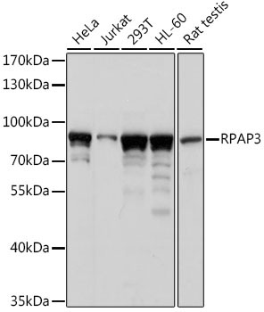 RPAP3 Rabbit Polyclonal Antibody