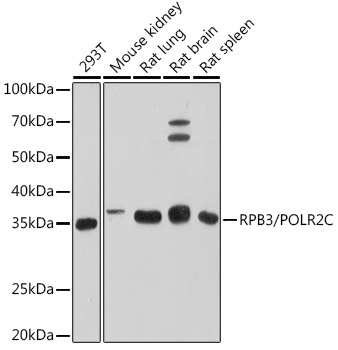 RPB3/POLR2C Rabbit Monoclonal Antibody