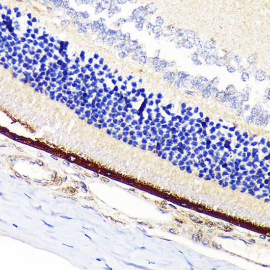 RPE65 Rabbit Monoclonal Antibody - Image 2