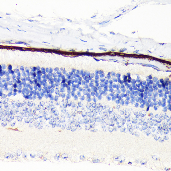 RPE65 Rabbit Monoclonal Antibody - Image 3
