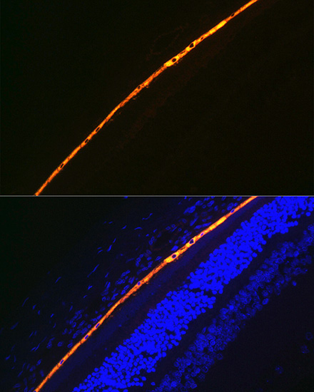 RPE65 Rabbit Monoclonal Antibody - Image 4