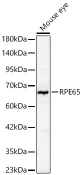 RPE65 Rabbit Polyclonal Antibody