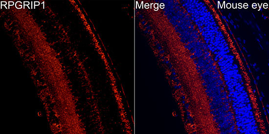 RPGRIP1 Rabbit Polyclonal Antibody