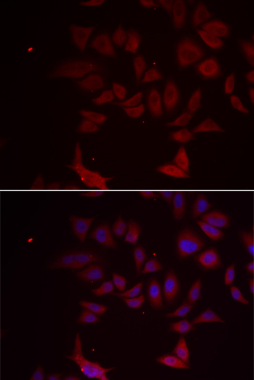 RPL11 Rabbit Polyclonal Antibody