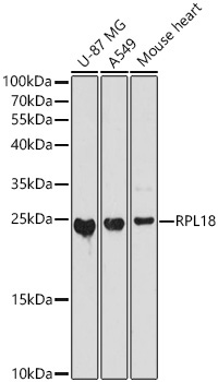 RPL18 Rabbit Polyclonal Antibody