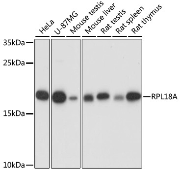 RPL18A Rabbit Polyclonal Antibody