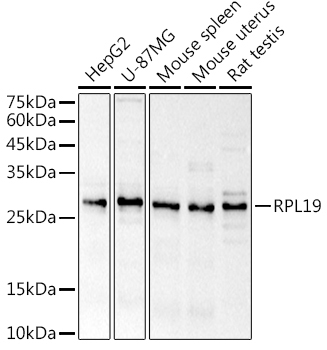 RPL19 Rabbit Polyclonal Antibody