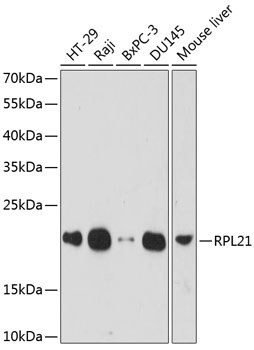 RPL21 Rabbit Polyclonal Antibody