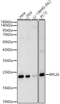 RPL26 Rabbit Polyclonal Antibody