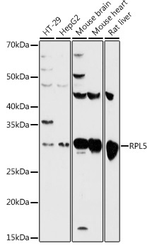 RPL5 Rabbit Polyclonal Antibody