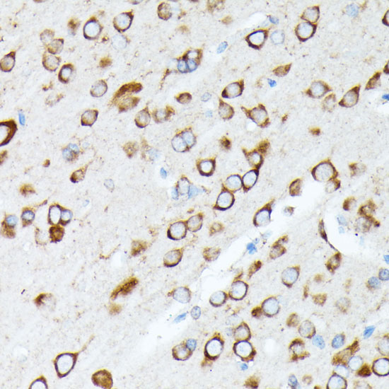 RPL7 Rabbit Polyclonal Antibody - Image 2