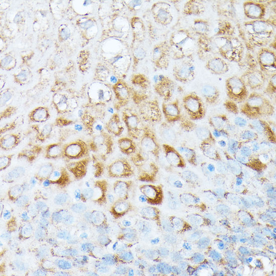 RPL7 Rabbit Polyclonal Antibody - Image 3