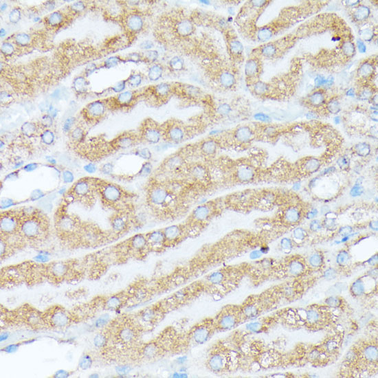 RPL7 Rabbit Polyclonal Antibody - Image 4