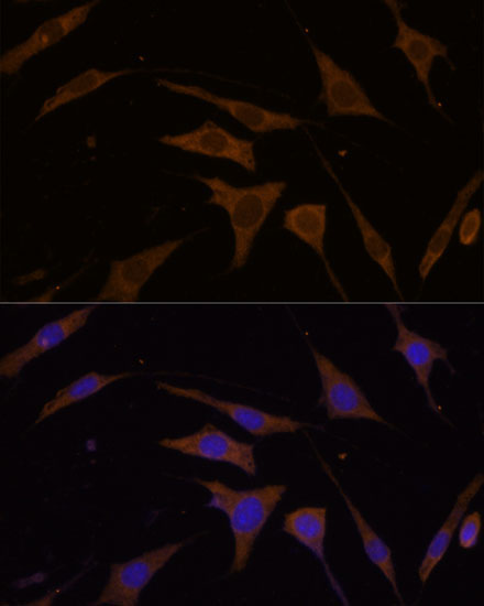 RPL7 Rabbit Polyclonal Antibody - Image 5