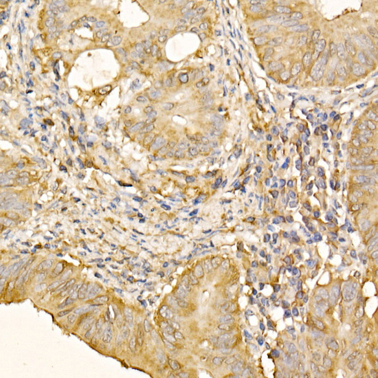 RPLP2 Rabbit Polyclonal Antibody