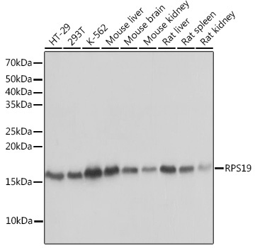 RPS19 Rabbit Monoclonal Antibody