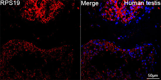 RPS19 Rabbit Monoclonal Antibody - Image 2