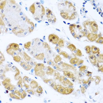 RPS2 Rabbit Polyclonal Antibody - Image 2