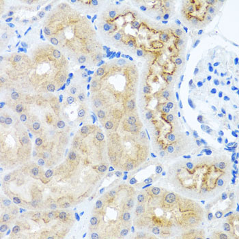 RPS2 Rabbit Polyclonal Antibody - Image 3