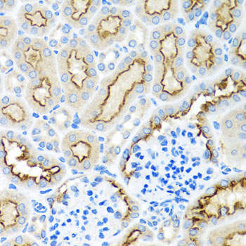 RPS2 Rabbit Polyclonal Antibody - Image 4