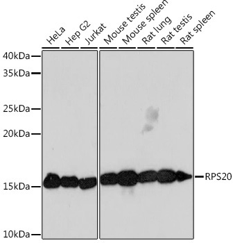 RPS20 Rabbit Monoclonal Antibody