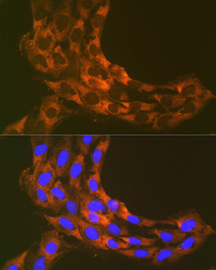 RPS20 Rabbit Monoclonal Antibody - Image 7