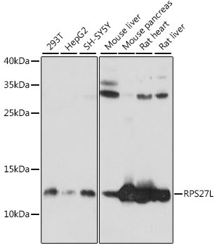 RPS27L Rabbit Polyclonal Antibody