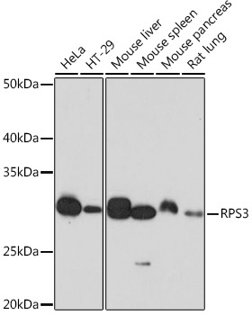 RPS3 Rabbit Monoclonal Antibody