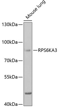 RPS6KA3 Rabbit Polyclonal Antibody